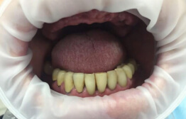 до